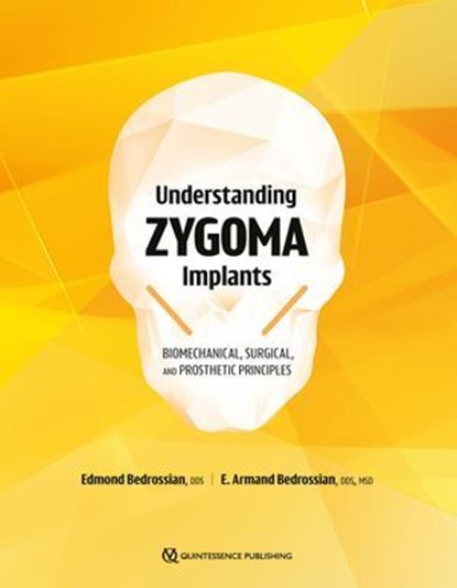 Understanding Zygoma Implants, Edmond Bedrossian ; E. Armand Bedrossian - Ebook - 9781647242213