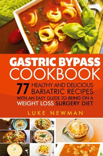Gastric Bypass Cookbook, Luke Newman - Gebonden - 9781647485658