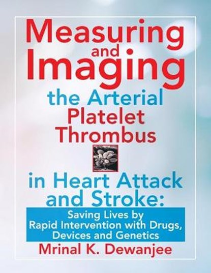 Measuring and Imaging the Arterial Platelet Thrombus in Heart Attack and Stroke, DEWANJEE,  Mrinal K - Paperback - 9781663212030