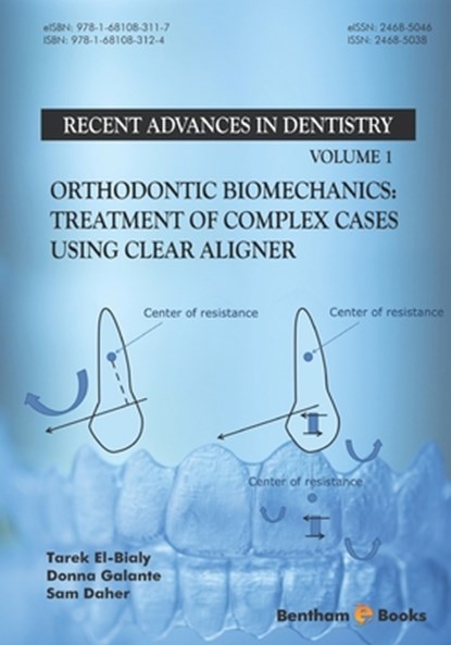 Orthodontic Biomechanics: Treatment Of Complex Cases Using Clear Aligner, Donna Galante - Paperback - 9781681083124