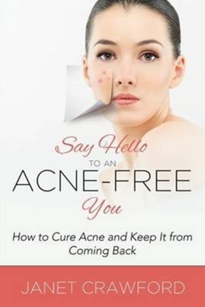Say Hello to an Acne-Free You, Janet Crawford - Paperback - 9781681275123