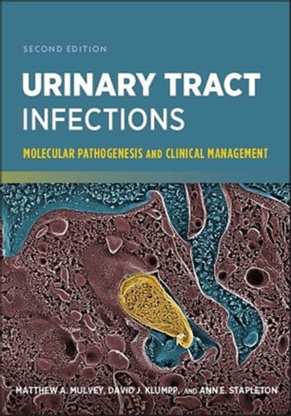 Urinary Tract Infections, Matthew A. Mulvey ; David J. Klumpp ; Ann E. Stapleton - Ebook - 9781683673149