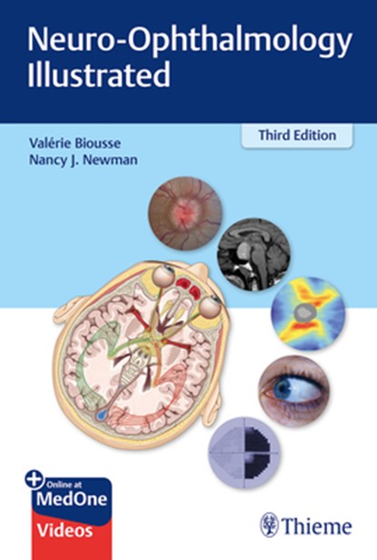 Neuro-Ophthalmology Illustrated, Valerie Biousse ; Nancy Newman - Paperback - 9781684200740