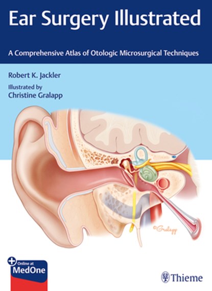 Ear Surgery Illustrated, Robert K. Jackler - Gebonden - 9781684201105