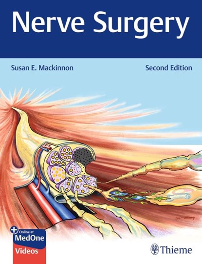 Nerve Surgery, Susan E. Mackinnon - Gebonden - 9781684204700