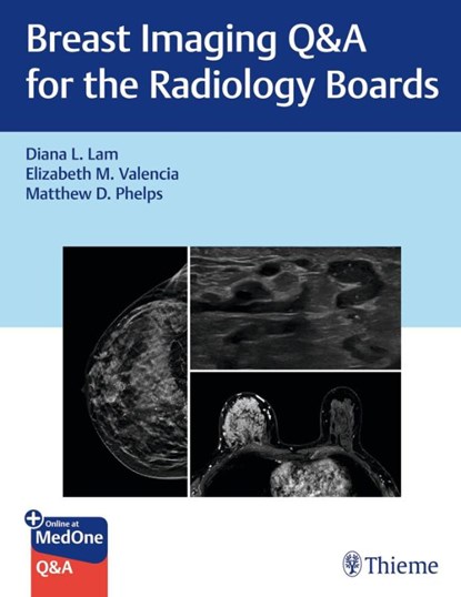 Breast Imaging Q&a for the Radiology Boards, Diana Lam ; Elizabeth Valencia ; Matthew Phelps - Paperback - 9781684207282