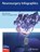 Neurosurgery Infographics, Nitin Agarwal ; David Fernandes Cabral - Paperback - 9781684207671