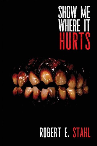 Show Me Where It Hurts, Robert E. Stahl - Paperback - 9781685101565