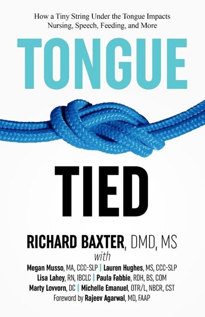 Tongue-Tied, MS DMD Richard Baxter - Paperback - 9781732508200