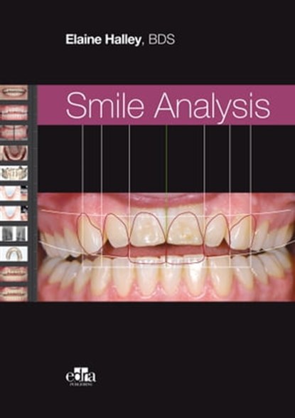Smile Analysis, Elaine Halley, BDS - Ebook - 9781737126195