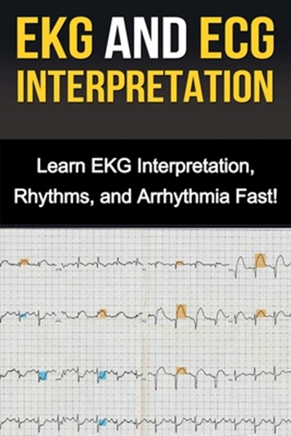 EKG and ECG Interpretation, Alyssa Stone - Paperback - 9781761031038