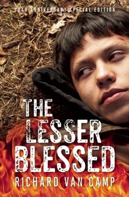 LESSER BLESSED -20TH ANNIVERSA, VAN CAMP,  Richard - Paperback - 9781771621137