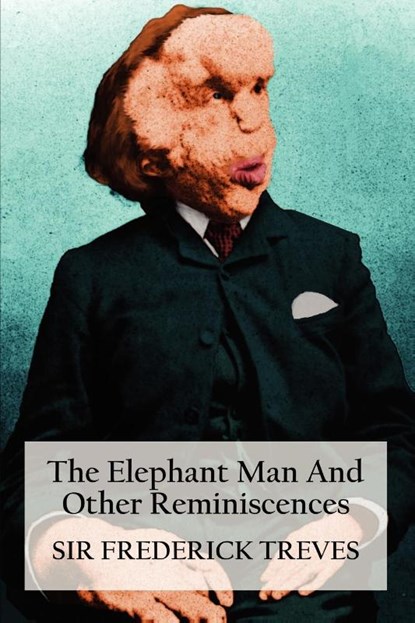 The Elephant Man And Other Reminiscences, Sir Frederick Treves - Paperback - 9781781391808