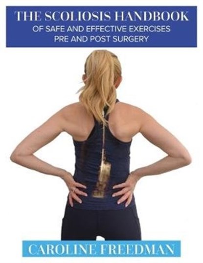 The Scoliosis Handbook of Safe and Effective Exercises Pre and Post Surgery, Caroline Freedman - Paperback - 9781781611661