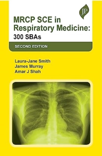 MRCP SCE in Respiratory Medicine, Laura-Jane Smith ; James Murray ; Amar J Shah - Paperback - 9781787791176