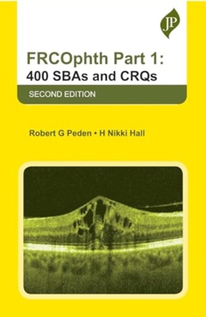 FRCOphth Part 1: 400 SBAs and CRQs, Robert G Peden ; H Nikki Hall - Paperback - 9781787791718