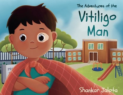 The Adventures of The Vitiligo Man, Shankar Jalota - Paperback - 9781802275650