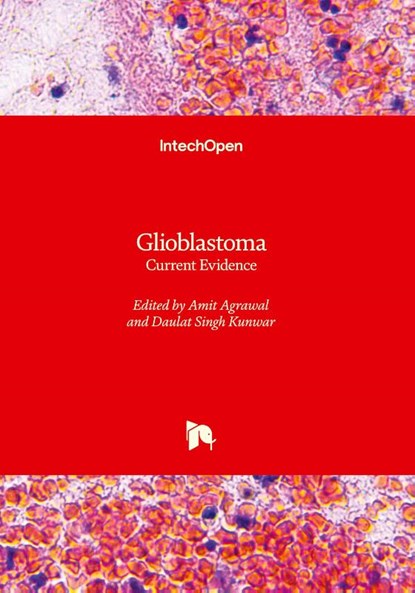 Glioblastoma, AGRAWAL,  Amit ; Kunwar, Daulat Singh - Gebonden - 9781803561288