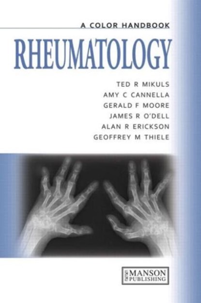Rheumatology, TED (PROFESSOR,  University of Nebraska Medical Center, USA) Mikuls ; Amy Cannella ; Gerald Moore ; James O'Dell ; Alan Erikson ; Geoffrey Thiele - Paperback - 9781840761733