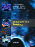 Imaging of the Prostate | Dennis Cochlin ; Barry B. Goldberg ; Ethan J. Halpern | 