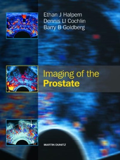 Imaging of the Prostate, niet bekend - Gebonden - 9781841841984