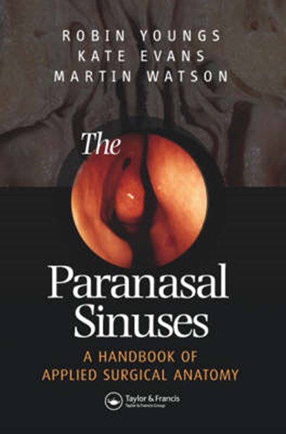 The Paranasal Sinuses, Robin Youngs ; Kathryn Evans ; Michael Watson - Gebonden - 9781841844244