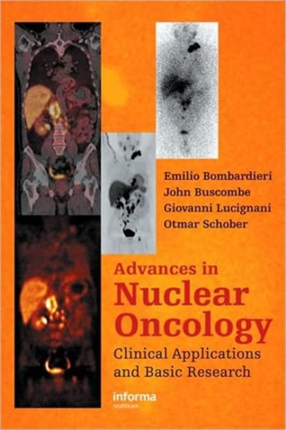 Advances in Nuclear Oncology, Emilio Bombardieri ; John Buscombe ; Giovanni Lucignani ; Otmar Schober - Gebonden - 9781841846149