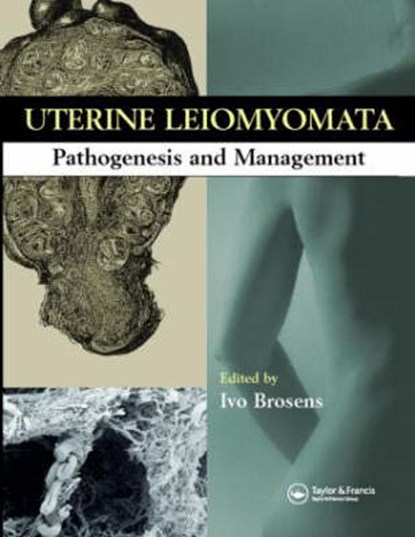 Uterine Leiomyomas, IVO (LEUVEN INSTITUTE FOR FERTILITY & EMBRYOLOGY,  Belgium) Brosens - Gebonden - 9781842143070