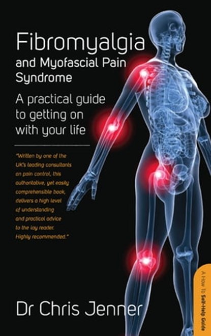 Fibromyalgia and Myofascial Pain Syndrome, DR Chris Jenner MB BS, FRCA, FFPMRCA - Ebook - 9781848033993