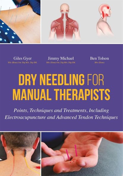 Dry Needling for Manual Therapists, Giles Gyer ; Jimmy Michael ; Ben Tolson - Gebonden - 9781848192553