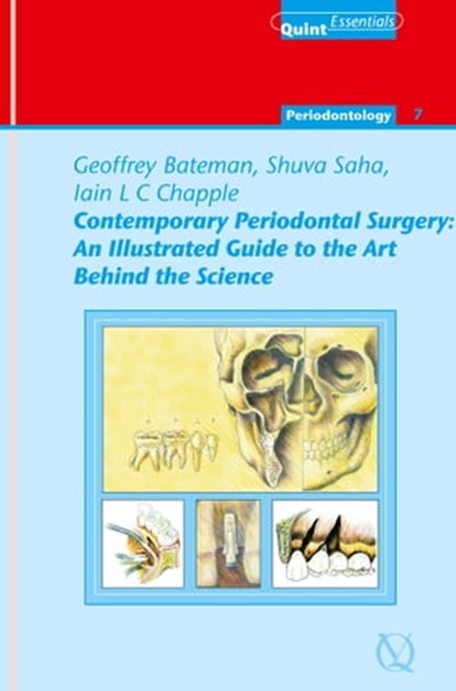 Contemporary Periodontal Surgery, Geoffrey Bateman ; Shuva Saha ; Iain L. C. Chapple - Ebook - 9781850973027