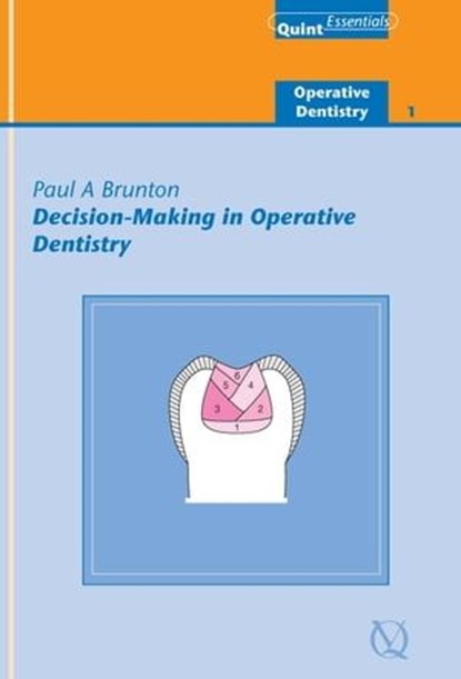 Decision-Making in Operative Dentistry, Paul A. Brunton - Ebook - 9781850973034