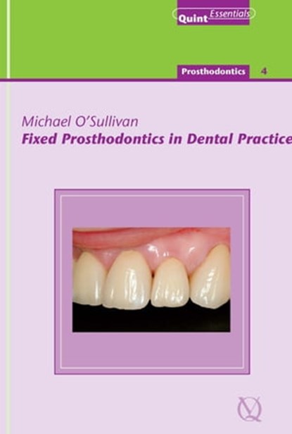 Fixed Prosthodontics in Dental Practice, Michael O'Sullivan - Ebook - 9781850973508