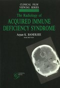 Radiology of Acquired Immune Deficiency Syndrome | Arpan K Banerjee | 