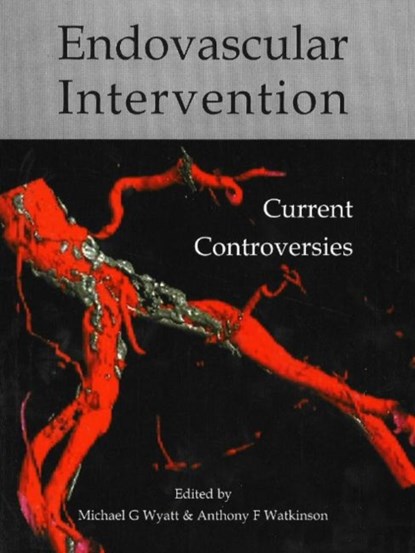 Endovascular intervention, Dr Michael G Wyatt ; Dr Anthony  F Watkinson - Paperback - 9781903378311