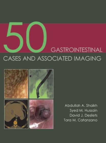 50 Gastrointestinal Cases and Associated Imaging, Dr Abdullah A. Shaikh ; Dr Syed M. Hussain ; Dr David J Desilets ; Dr Tara M. Catanzano - Paperback - 9781903378854