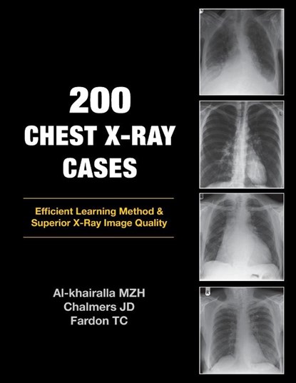 200 Chest X-Ray Cases, Mudher Al-khairalla ; James Chalmers ; Tom Fardon - Paperback - 9781905006366