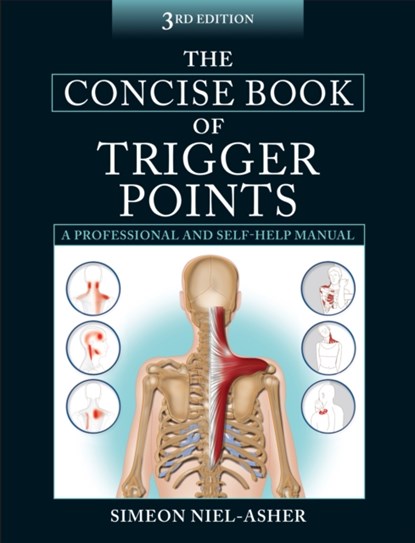 The Concise Book of Trigger Points, Simeon Niel-Asher - Paperback - 9781905367511