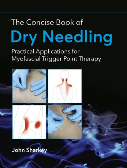 The Concise Book of Dry Needling, John Sharkey - Paperback - 9781905367672