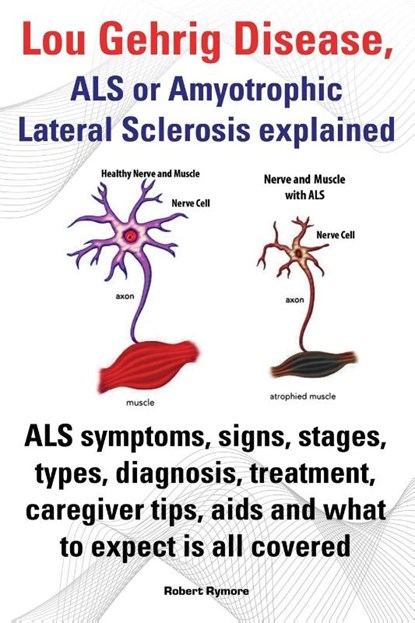 Lou Gehrig Disease, ALS or Amyotrophic Lateral Sclerosis explained. ALS symptoms, signs, stages, types, diagnosis, treatment, caregiver tips, aids and what to expect all covered., Robert Rymore - Paperback - 9781909151604