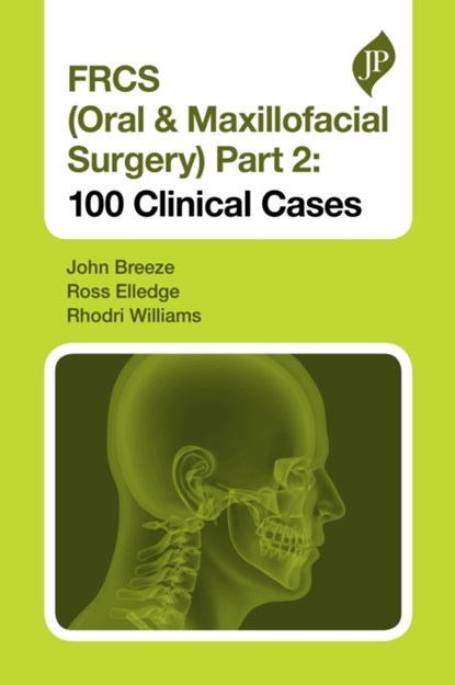 FRCS (Oral & Maxillofacial Surgery) Part 2: 100 Clinical Cases, John Breeze ; Ross Elledge ; Rhodri Williams - Paperback - 9781909836839