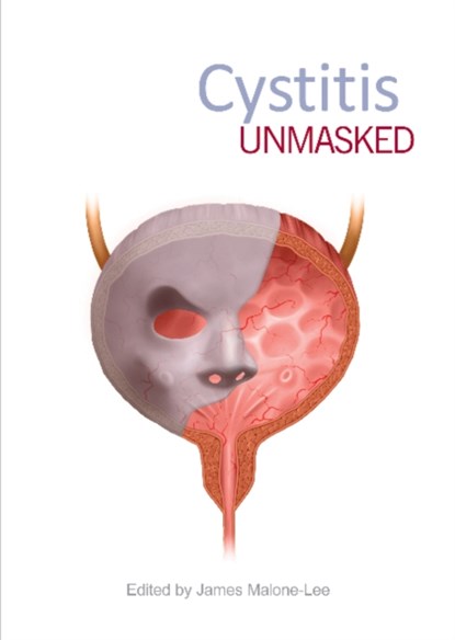 Cystitis Unmasked, James Malone-Lee - Paperback - 9781910079638