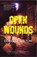 Open Wounds, Douglas Skelton - Paperback - 9781910745335