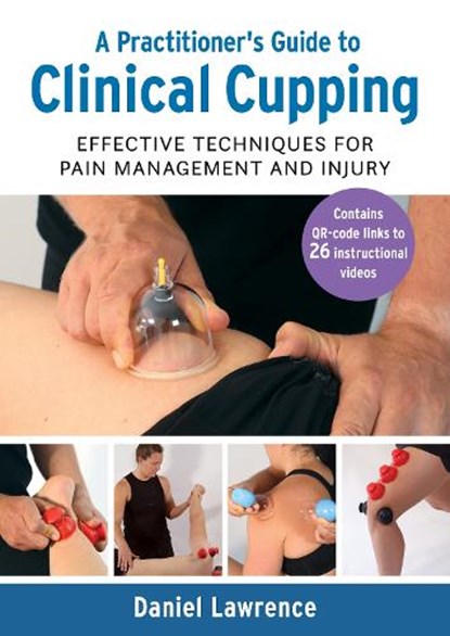 A Practitioner's Guide to Clinical Cupping, Daniel Lawrence - Paperback - 9781913088330