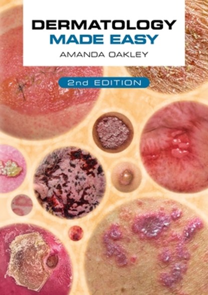 Dermatology Made Easy, second edition, Amanda (Honorary Professor Oakley - Paperback - 9781914961168