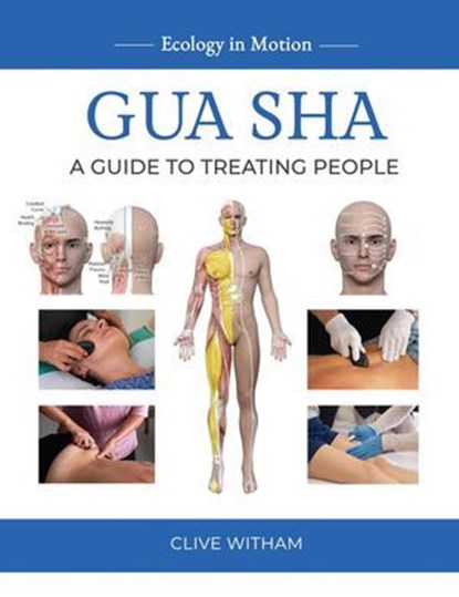 Gua sha: A Guide to Treating People, Clive Witham - Ebook - 9781916898370