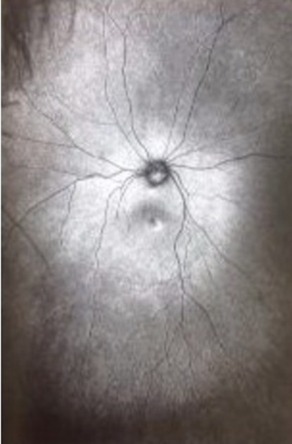 Supplement 3: The Invention and Conclusion of the Eye, Toril Johannessen - Paperback - 9781927354346