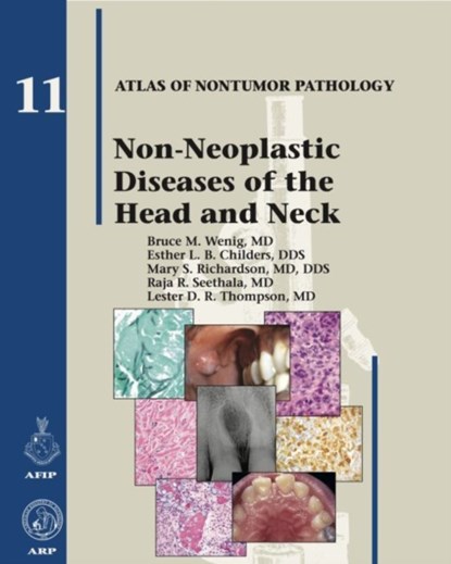 Non-Neoplastic Diseases of the Head and Neck, BRUCE M. WENIG ; ESTHER L. B. CHILDERS ; MARY S. RICHARDSON ; RAJA R.,  MD Seethala ; Lester D. R. Thompson - Gebonden - 9781933477374