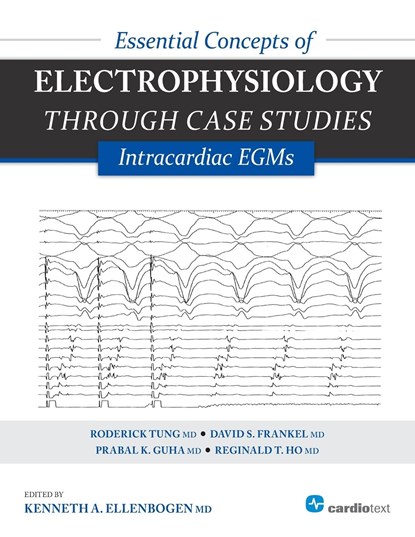 Essential Concepts of Electrophysiology Through Case Studies: Intracardiac EGMs, Kenneth a Ellenbogen ; Roderick Tung ; David Frankel - Paperback - 9781935395331