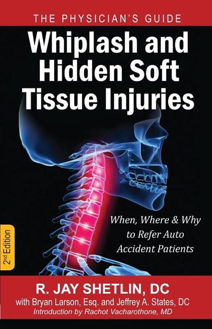 Whiplash and Hidden Soft Tissue Injuries, Dr R Jay Shetlin - Paperback - 9781937506735